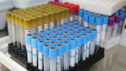 Новая донация антирезусной плазмы запускается в Лермонтове